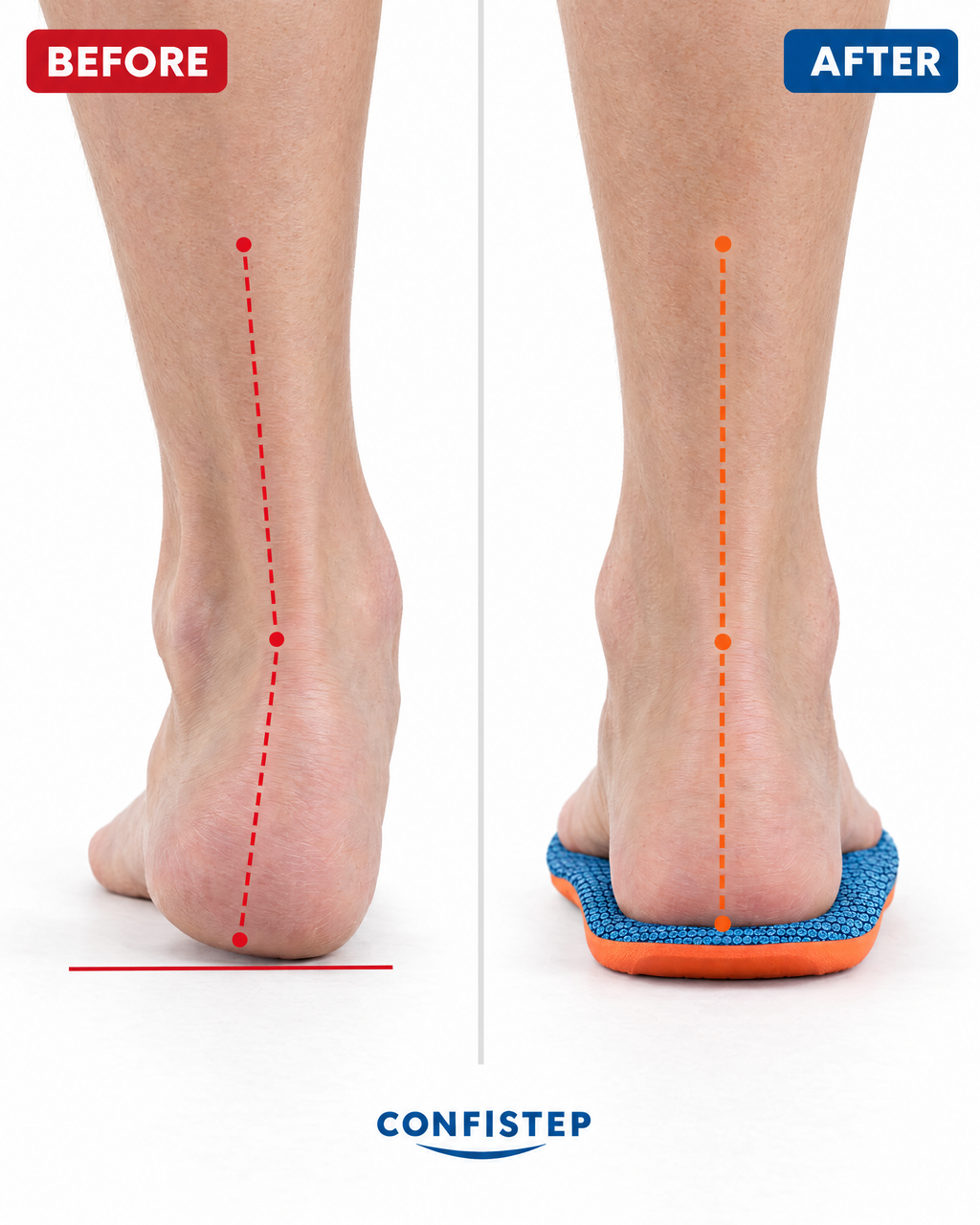 Confistep Comfort Insoles